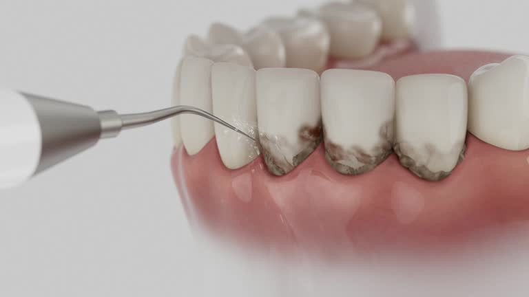 Reliable Dental contractor in Mount Orab, OH by Smile Center Dentistry